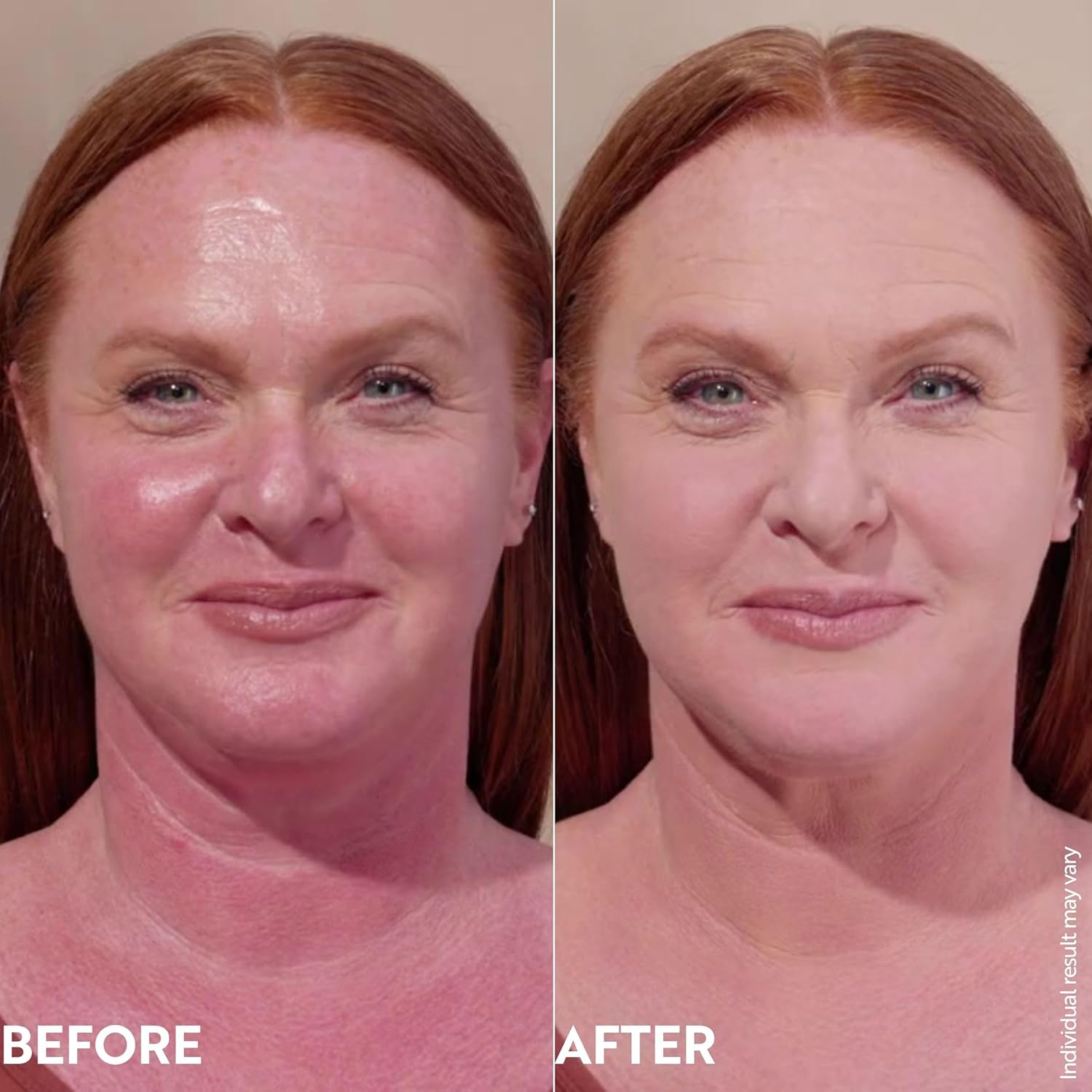 M. Asam Magic Finish Make-Up Mousse (1.01 Fl Oz) – 4in1 Primer, Foundation, Concealer & Powder With Buildable Coverage, Hides Redness And Dark Spots, Vegan, For Light To Medium Skin Tones